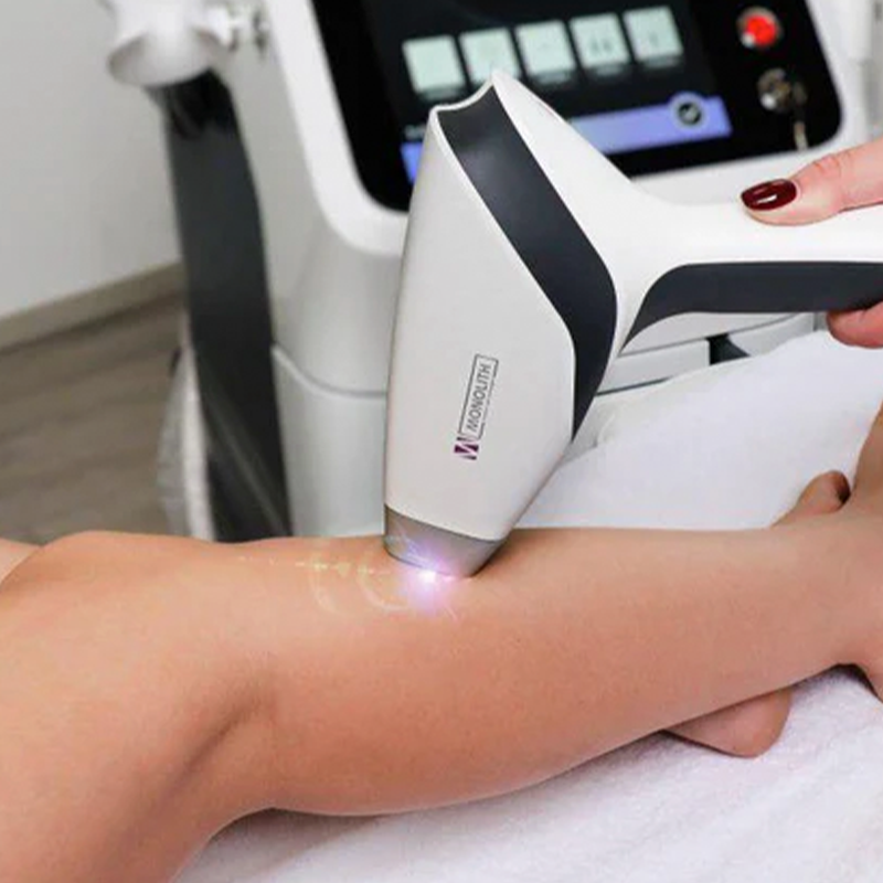 PELZ Derma Clinic Depilación Láser Mediostar_2