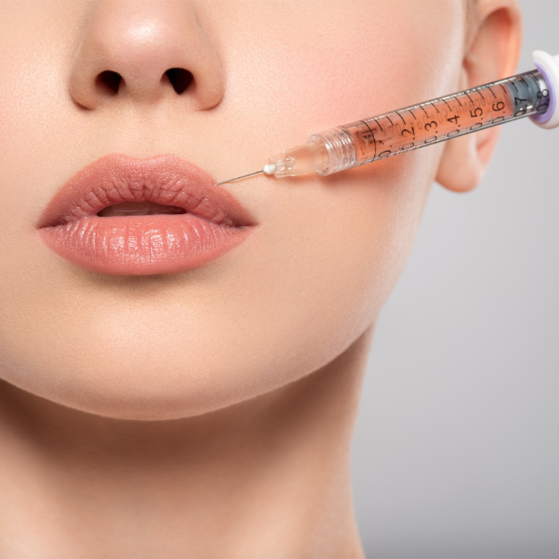 PELZ Derma Clinic Filler Ácido Hialurónico_2 PELZ Derma Clinic Filler Ácido Hialurónico_2