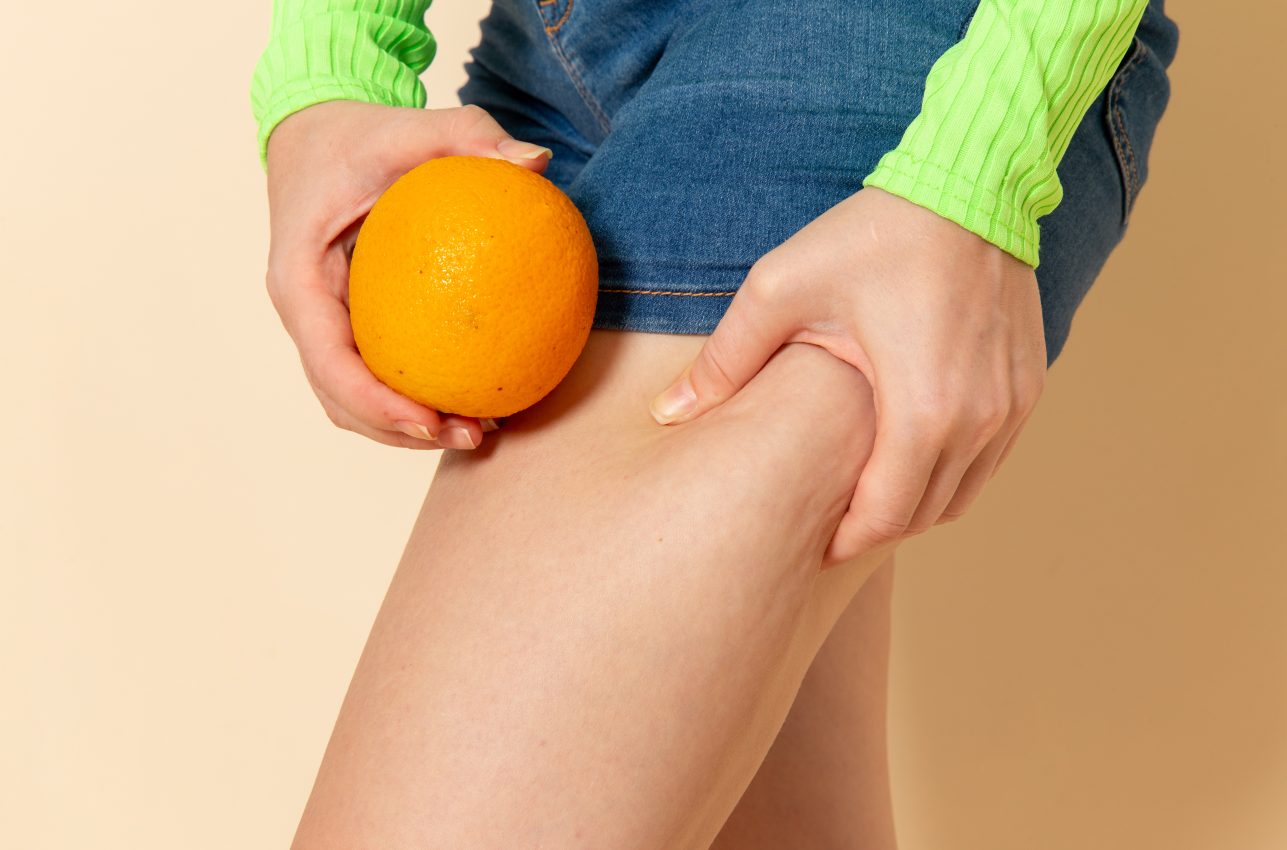 PELZ Derma Clinic Como Eliminar la Celulitis