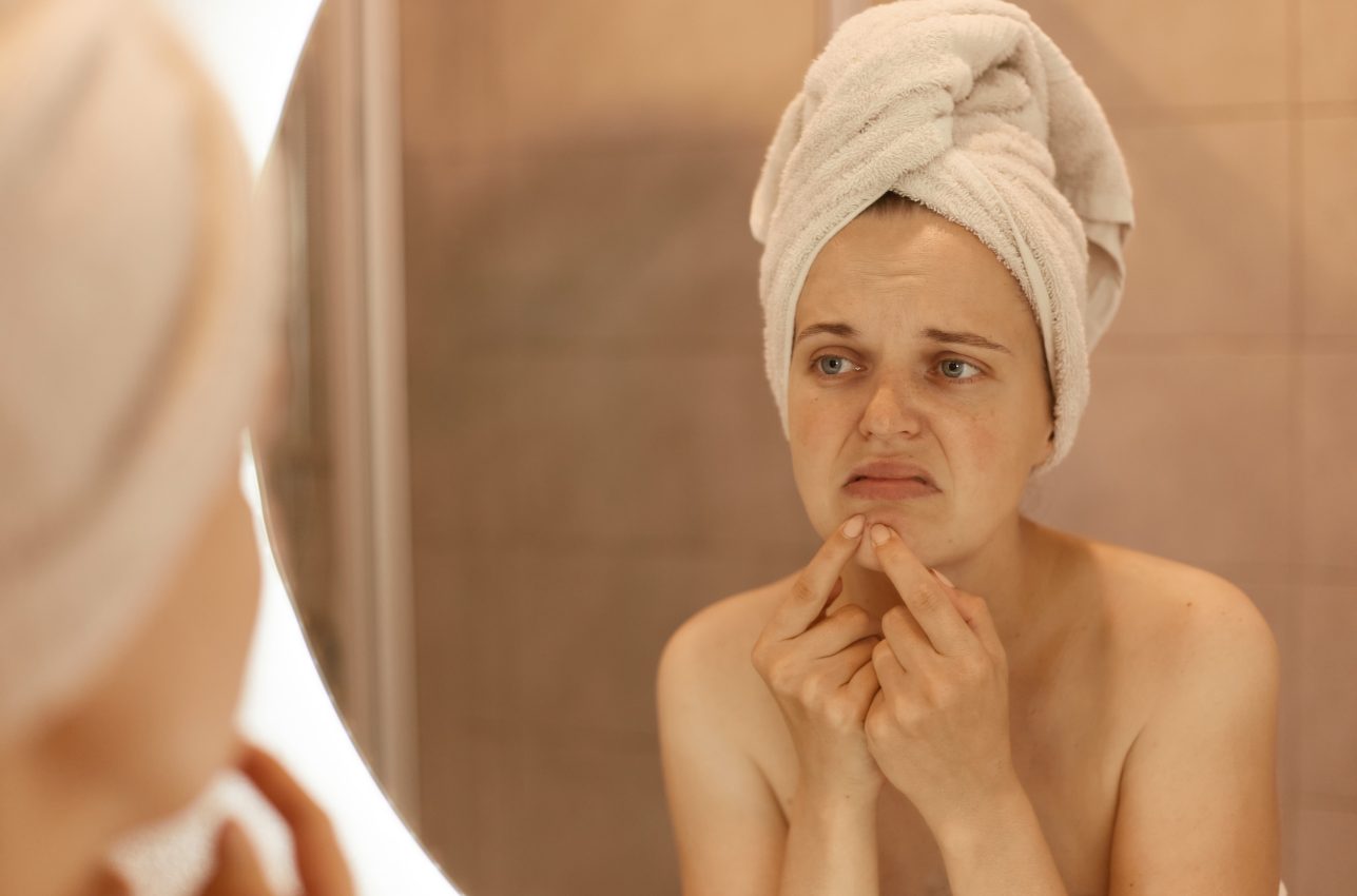 PELZ Derma Clinic Mitos del Acne